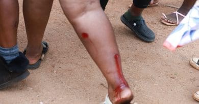 MAPHORISA MA BALESELA VA KOMBISA KU VILELA