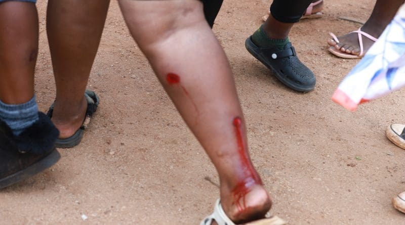 MAPHORISA MA BALESELA VA KOMBISA KU VILELA